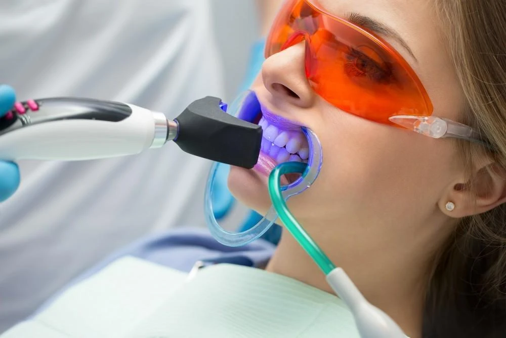 How Professional Teeth Whitening Works