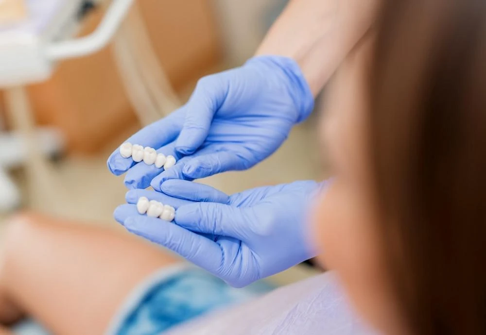 4 Reasons You May Need a Dental Crown