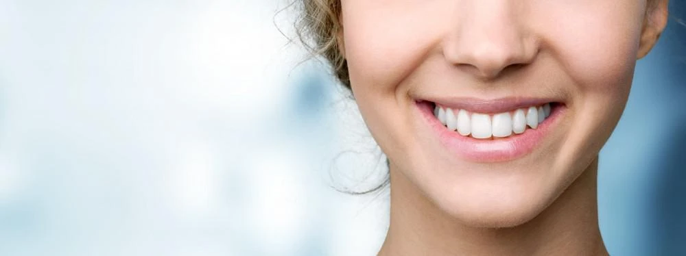 5 Problems That Veneers Resolve