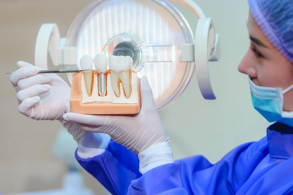 Who Is a Good Candidate for Dental Implants?